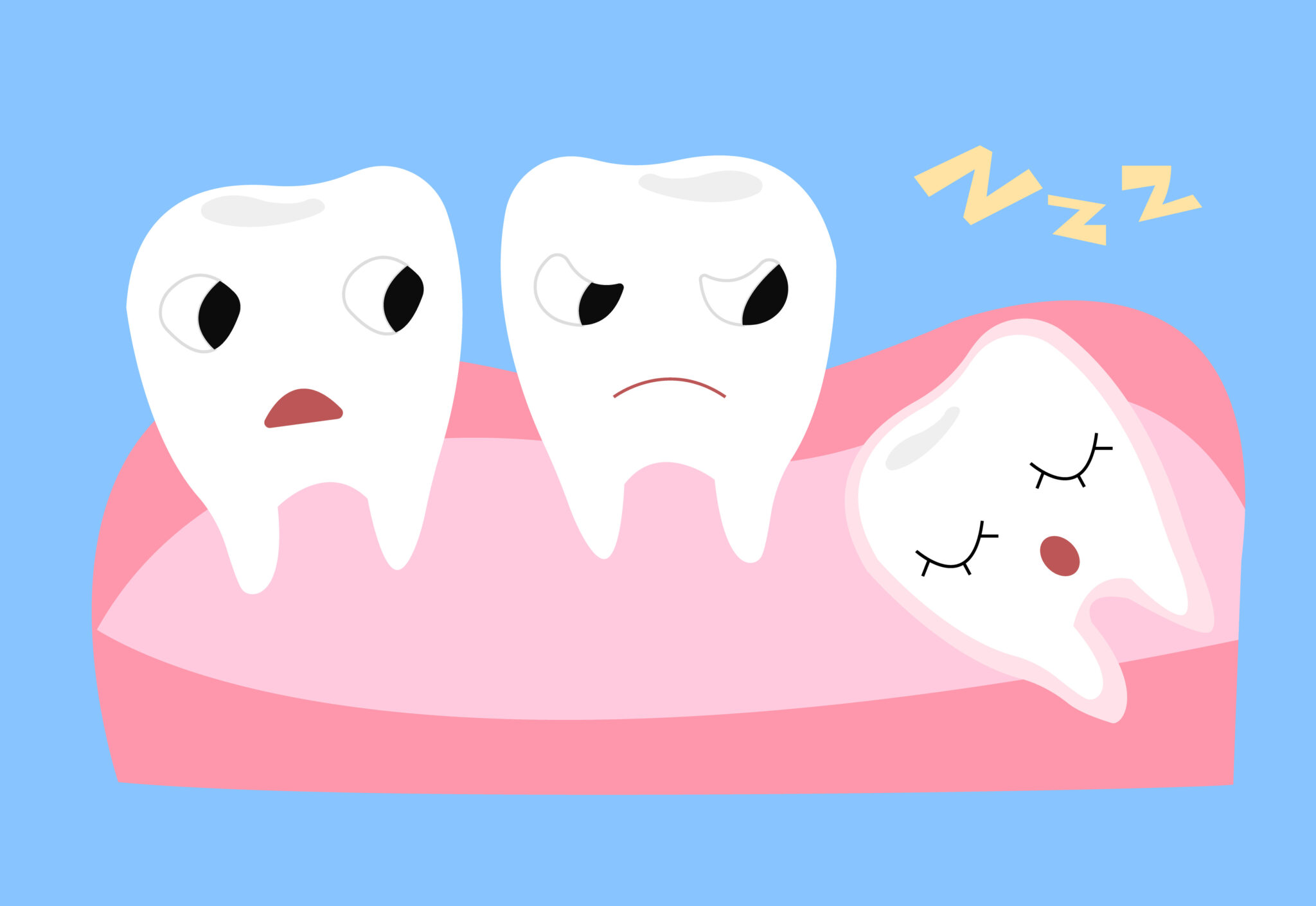 Dents de sagesse tout ce que vous devez savoir ! Centres Dentaires Docali